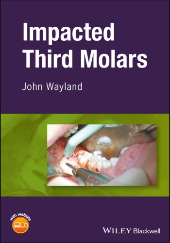 Impacted Third Molars2018