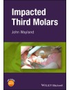 28328498-RP-Impacted Third Molars (2018) cover.jpg