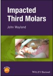 Impacted Third Molars2018