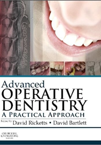Advanced Operative Dentistry