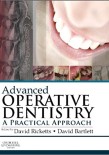 Advanced Operative Dentistry