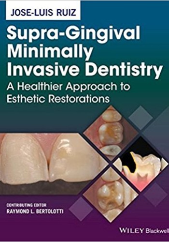 Supra-Gingival Minimally Invasive Dentistry
