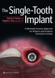 The Single-Tooth Implant 2020