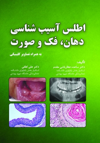 اطلس آسیب شناسی دهان، فک و صورت