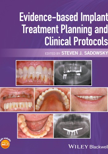 Evidence‐based Implant Treatment Planning and Clinical Protocols