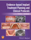 340-RP-Evidence-Based Implant Treatment Planning and Clinical Protocols (2017).jpg