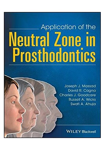 Application of the Neutral Zone in Prosthodontics 2017 