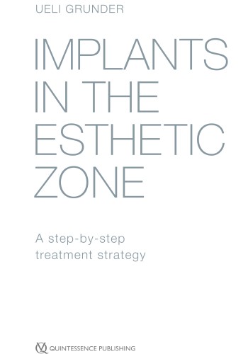 Implants in the Esthetic Zone 2016