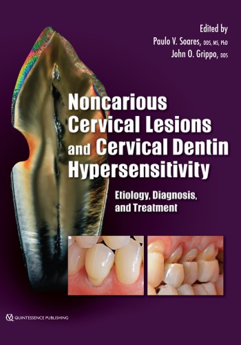 Noncarious Cervical Lesions and Cervical Dentin Hypersensitivity 2017 