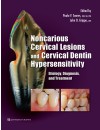 366-RP-Noncarious Cervical Lesions and Cervical Dentin Hypersensitivity (2017).jpg