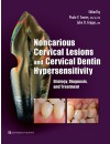 366-RP-Noncarious Cervical Lesions and Cervical Dentin Hypersensitivity (2017).jpg