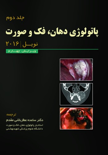 پاتولوژی دهان،فک و صورت نویل 2016 - جلد دوم (سیاه سفید)