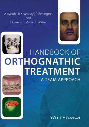 Handbook of Orthognathic Treatment 2014