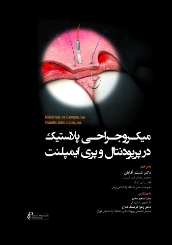 میکروجراحی پلاستیک در پریودنتال و پری ایمپلنت تکنیکهای کم تهاجمی با حداکثر دقت - کاغذ گلاسه