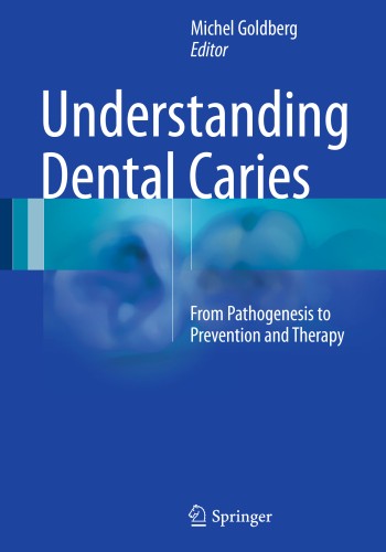 Understanding Dental Caries 2016