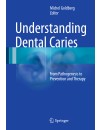 388-RP-Understanding Dental Caries (2016).jpg