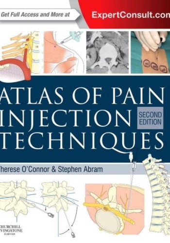 Atlas of Pain Injection Techniques 2014 