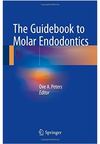 The Guidebook to Molar Endodontics2017