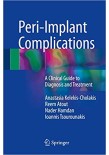 Peri-Implant Complications 2018