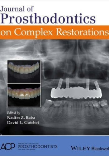 JOURNAL OF PROSTHODONTICS ON COMPLEX RESTORATIONS 2016
