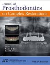 428-RP-Journal of Prosthodontics on Complex Restorations (2016).jpg