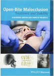 Open-Bite Malocclusion Treatment and Stability 2014