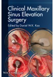 Clinical Maxillary Sinus Elevation Surgery 2014