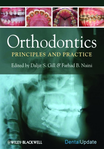 Orthodontics: Principles and Practice 2011