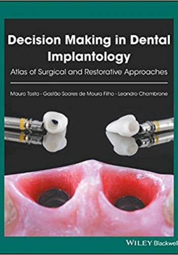 Decision Making in Dental Implantology 2018