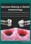 Decision Making in Dental Implantology 2018