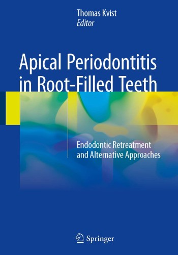 Apical Periodontitis in Root-Filled Teeth 2018