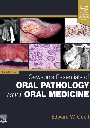 Cawson's Essentials of Oral Pathology and Oral Medicine 2025