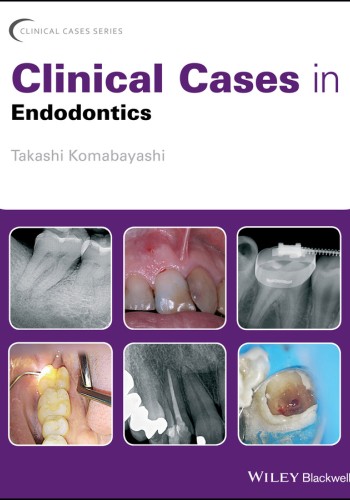 Clinical Cases in Endodontics 2018