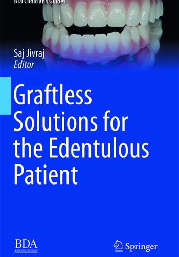 Graftless Solutions for the Edentulous Patient 2018