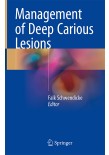 Management of Deep Carious Lesion 2018