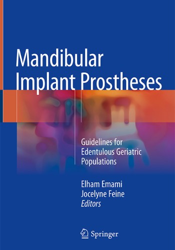 Mandibular Implant Prostheses 2018