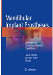 Mandibular Implant Prostheses 2018
