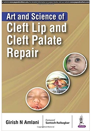 Art and Science of Cleft Lip and Cleft Palate Repair2018