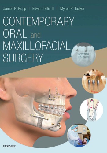 Contemporary Oral and Maxillofacial Surgery 2019 peterson . hupp