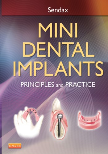 Mini Dental Implants 2013 