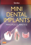 Mini Dental Implants 2013 