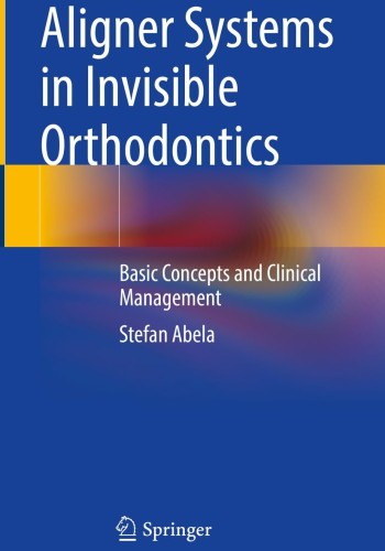 Aligner Systems in Invisible Orthodontics: Basic Concepts and Clinical Management 2024