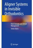 Aligner Systems in Invisible Orthodontics: Basic Concepts and Clinical Management 2024