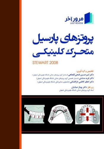 مرور آخر ، پروتزهای پارسیل متحرک کلینیکی استوارت (Stewart 2008)