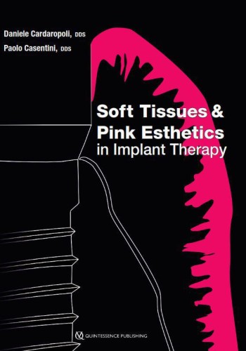 Soft Tissues and Pink Esthetics in Implant Therapy2020