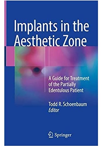 Implants in the Aesthetic Zone2018