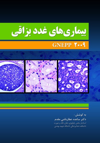 بیماری های غدد بزاقی (Gnepp 2009)
