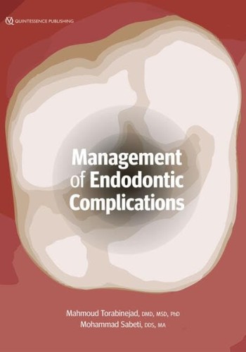 Management of Endodontic Complications: From Diagnosis to Prognosis 2023