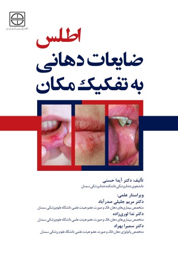 اطلس ضایعات دهانی به تفکیک مکان