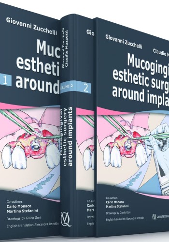 Mucogingival Esthetic Surgery Around Implants 2022